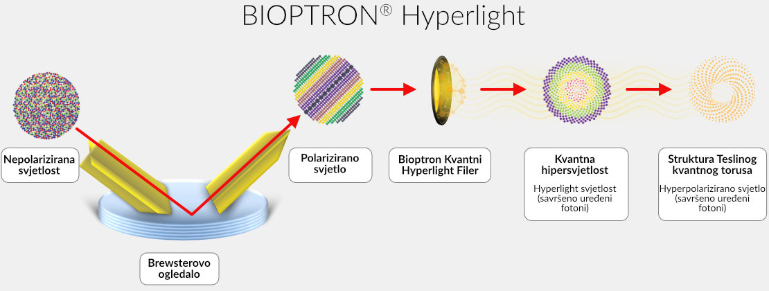 DiagramHyperpolarizedLight-XL